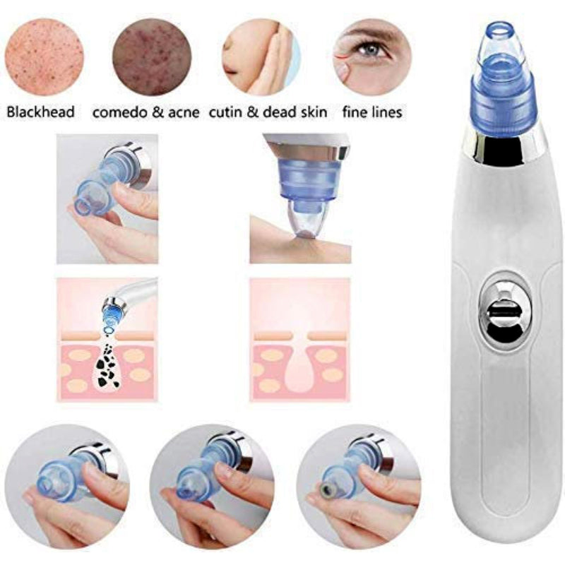 DermaSuction Vacuum Pore Cleaning Device With 4 Interchangeable Suction Heads